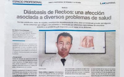 Diástasis de Rectos: una afección asociada a diversos problemas de salud (Nota en La Capital)