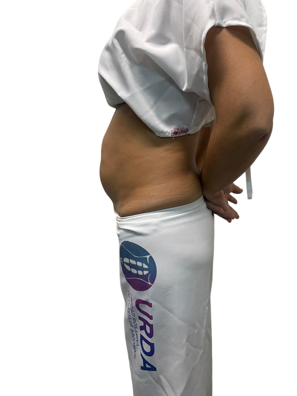 perfil hinchazon perfil hinchazon